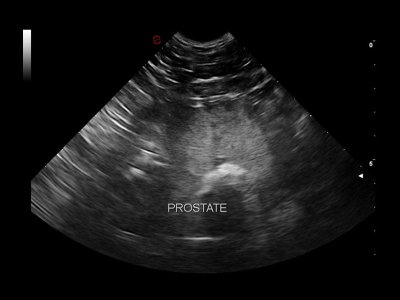 Pes prostata